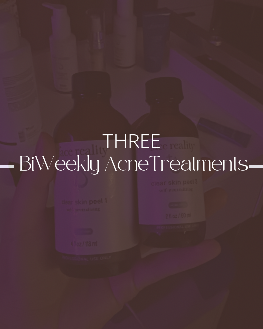 3 Acne Treatments (BiWeekly)