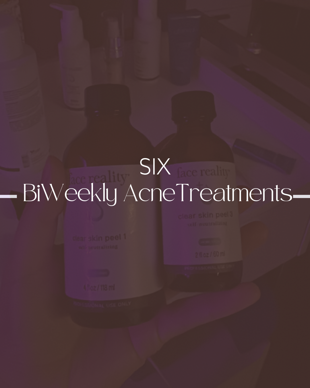6 Acne Treatments (BiWeekly)