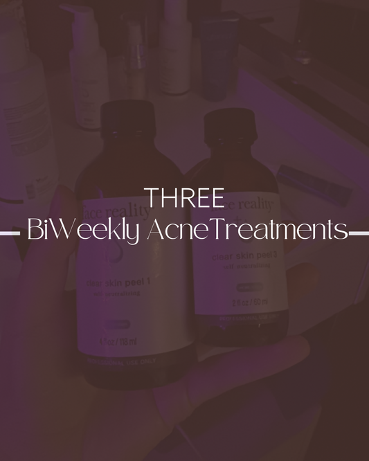 3 Acne Treatments (BiWeekly)